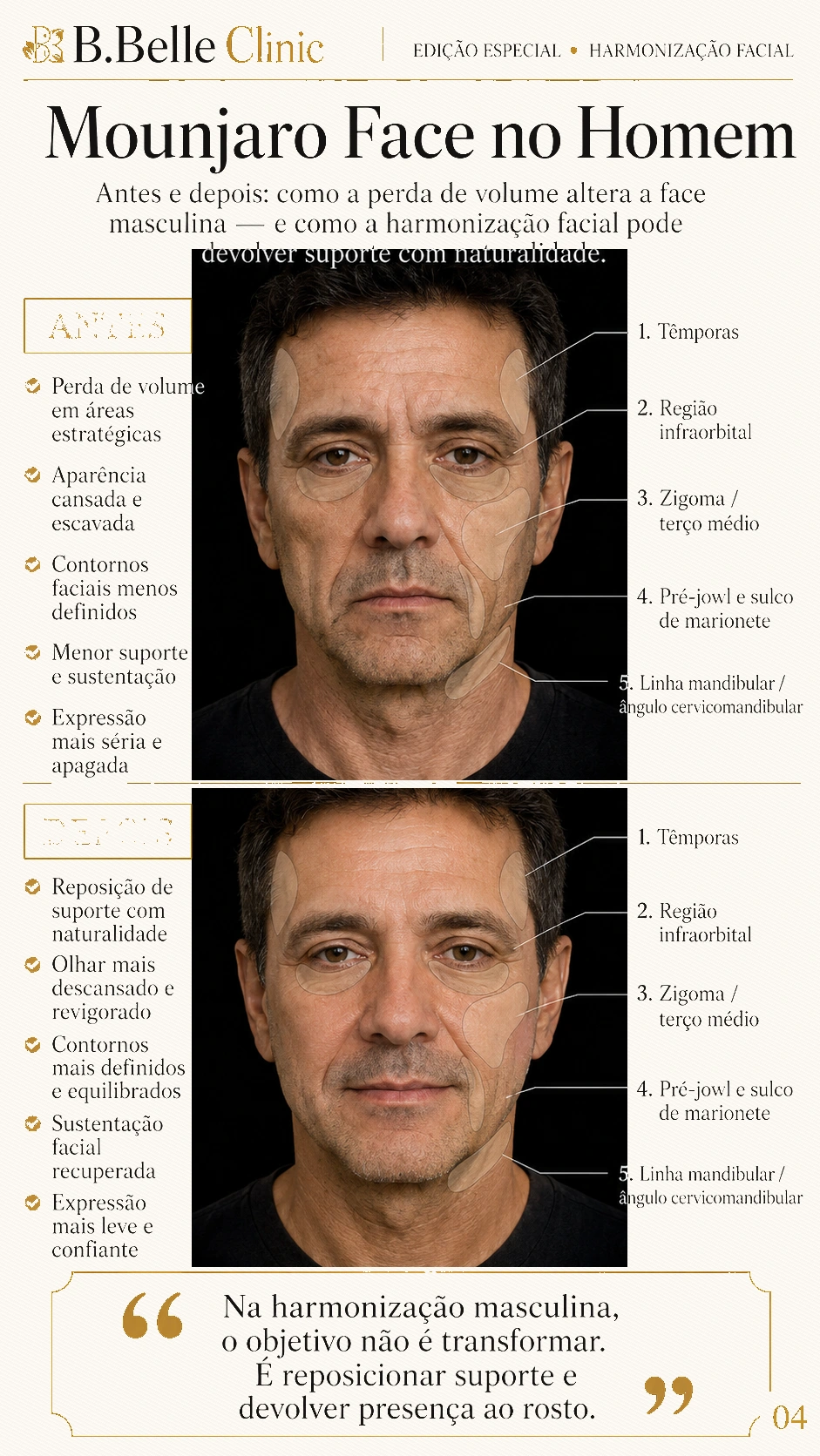 Comparativo masculino sobre Mounjaro Face e harmonização facial com suporte natural