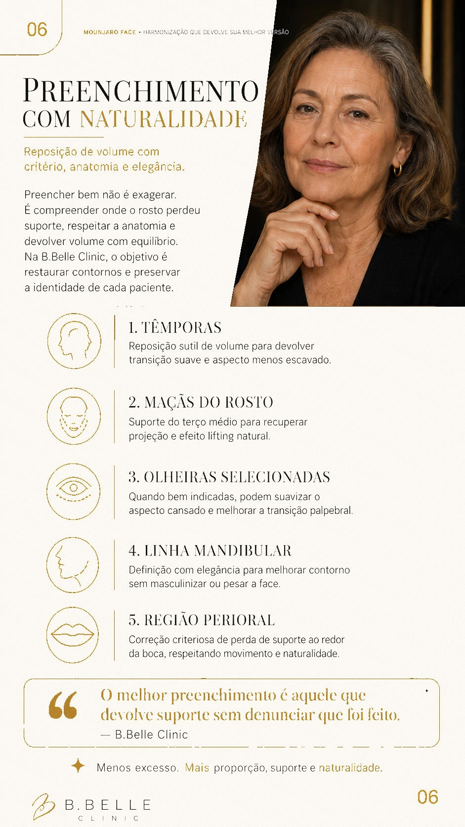 Página 06 sobre preenchimento com naturalidade em têmporas, maçãs do rosto, olheiras, mandíbula e região perioral